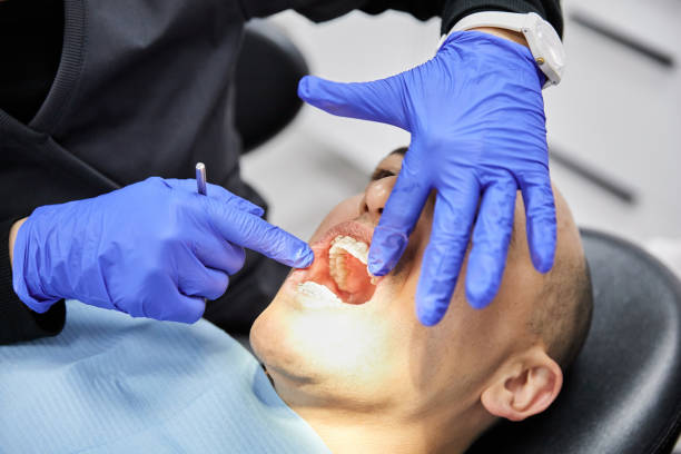 Best Emergency Root Canal Therapy in Wheaton, MN
